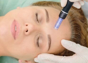Workshop: Microneedling